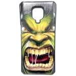 Redmi Note 9s 9 Pro Protector Case Diseño + Vidrio Templado