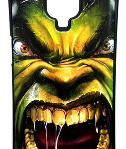 Redmi Note 9s 9 Pro Protector Case Diseño + Vidrio Templado